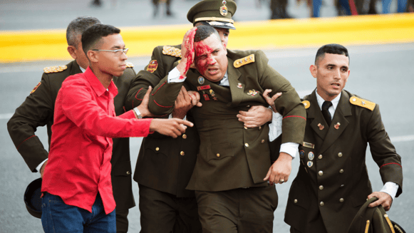 Venezuela Drone Attack - Soldier Injury